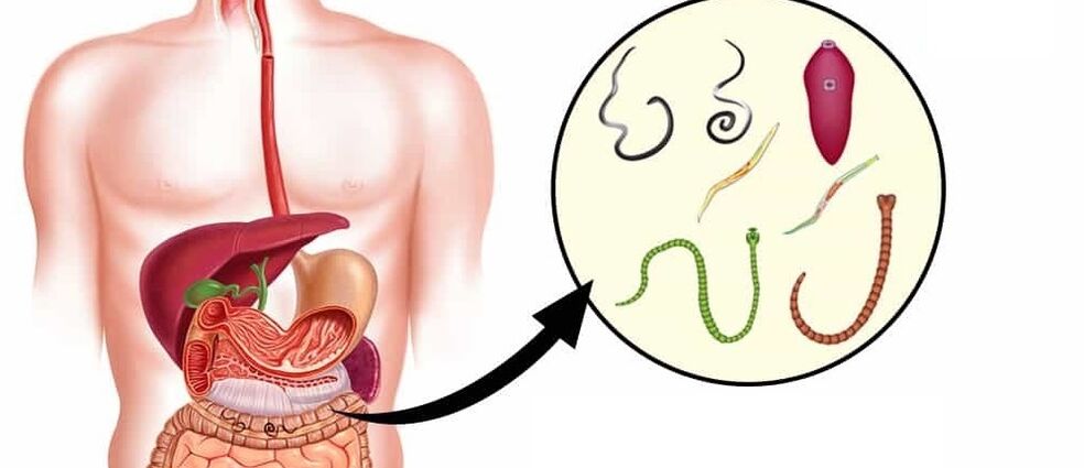 Parasiten im menschlichen Körper