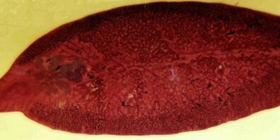 Trematodenparasiten, wie man sie aus dem Körper entfernt