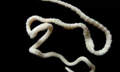 wie man den Cestodenparasiten aus dem Körper entfernt