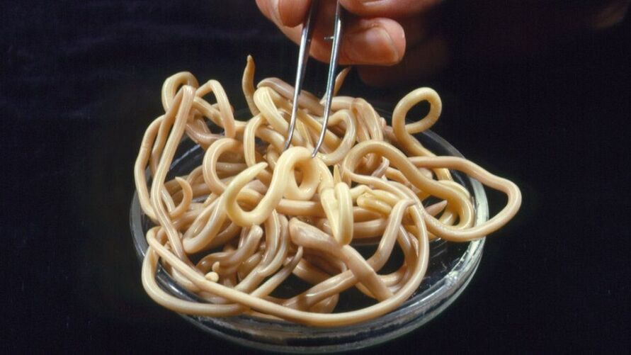 Parasiten aus dem menschlichen Körper